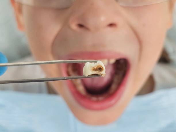 Best Weekend Emergency Dentist in Waverly, IL